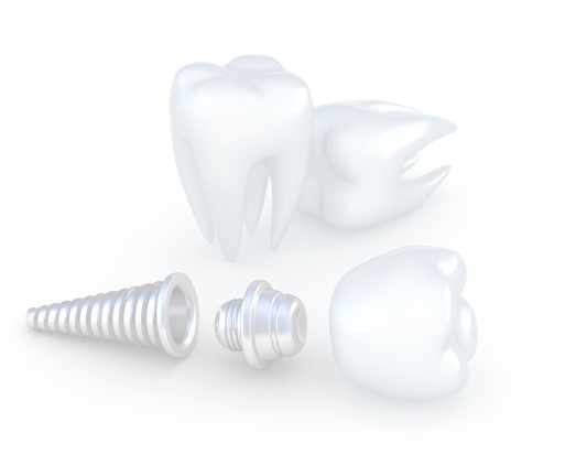 зубы и имплантаты