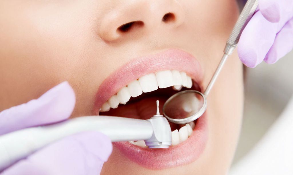 5 причин пройти лечение кариеса в стоматологической клинике ЕС.jpg